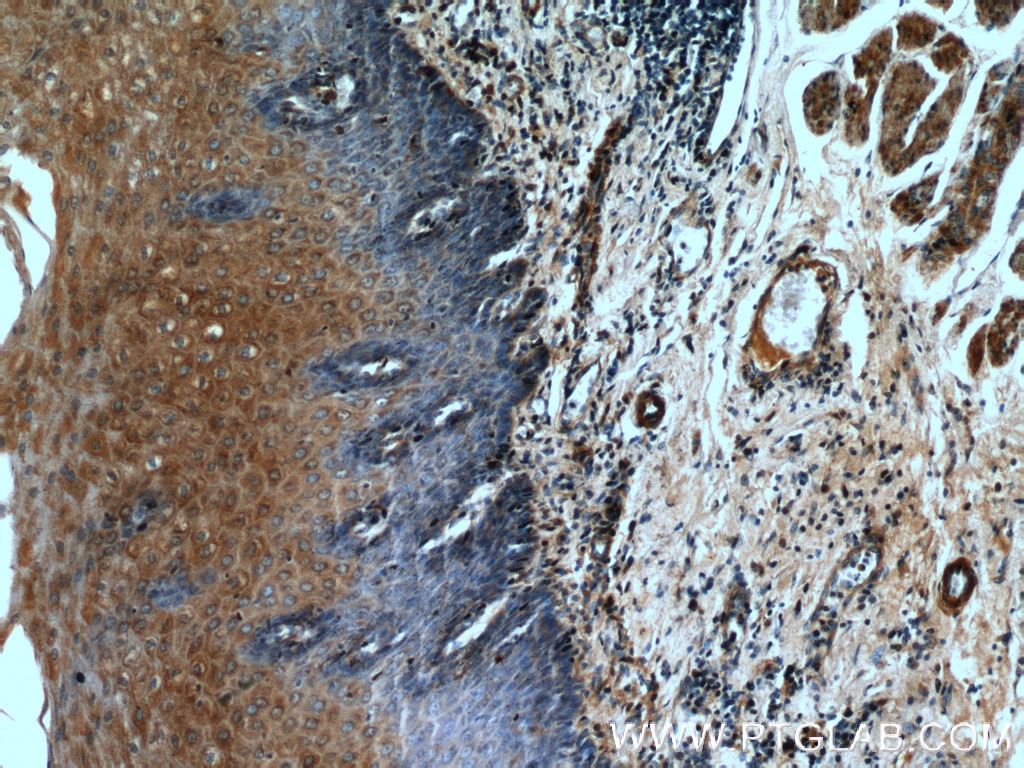 IHC staining of human oesophagus using 27080-1-AP