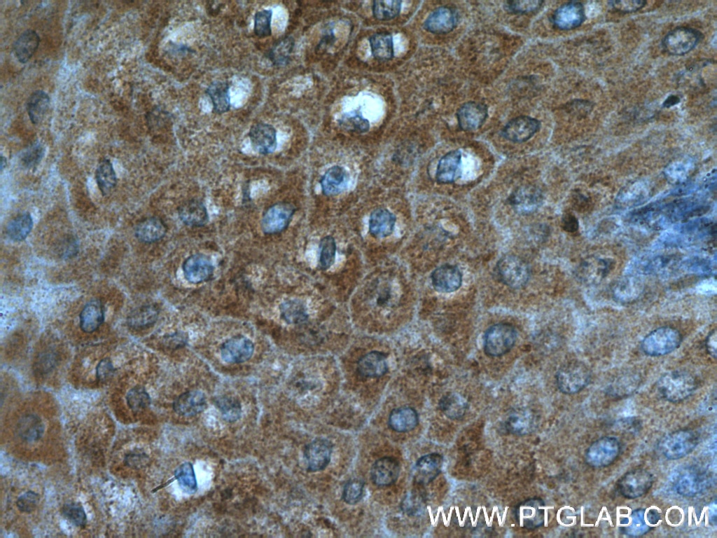 Immunohistochemistry (IHC) staining of human oesophagus tissue using DKK4 Polyclonal antibody (27080-1-AP)