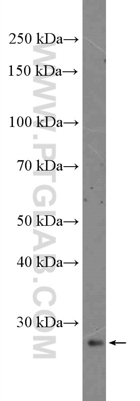 Western Blot (WB) analysis of mouse cerebellum tissue using DKK4 Polyclonal antibody (27080-1-AP)