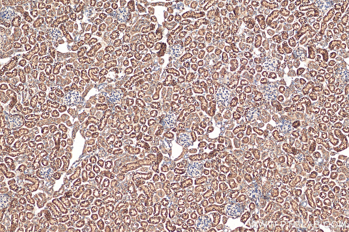 Immunohistochemistry (IHC) staining of mouse kidney tissue using DLAT Polyclonal antibody (13426-1-AP)