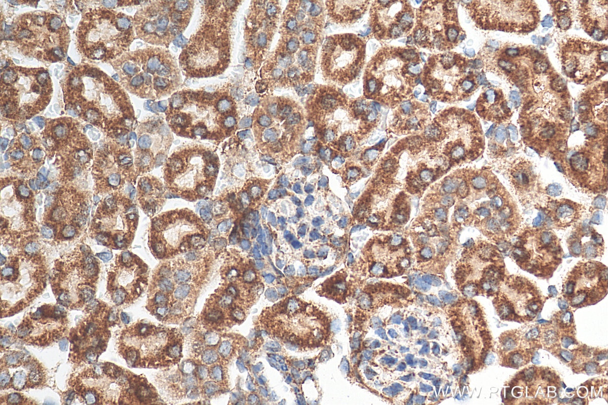 Immunohistochemistry (IHC) staining of mouse kidney tissue using DLAT Polyclonal antibody (13426-1-AP)
