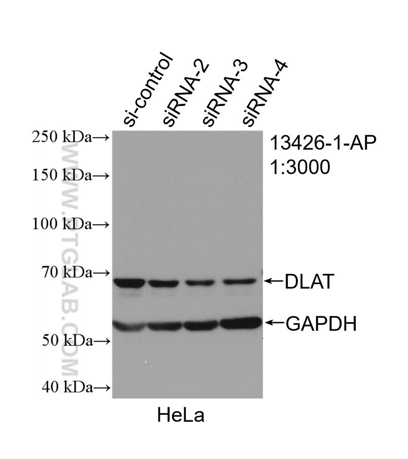 Western Blot (WB) analysis of HeLa cells using DLAT Polyclonal antibody (13426-1-AP)