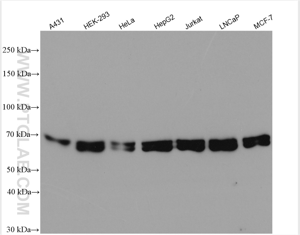 Western Blot (WB) analysis of various lysates using DLAT Polyclonal antibody (13426-1-AP)