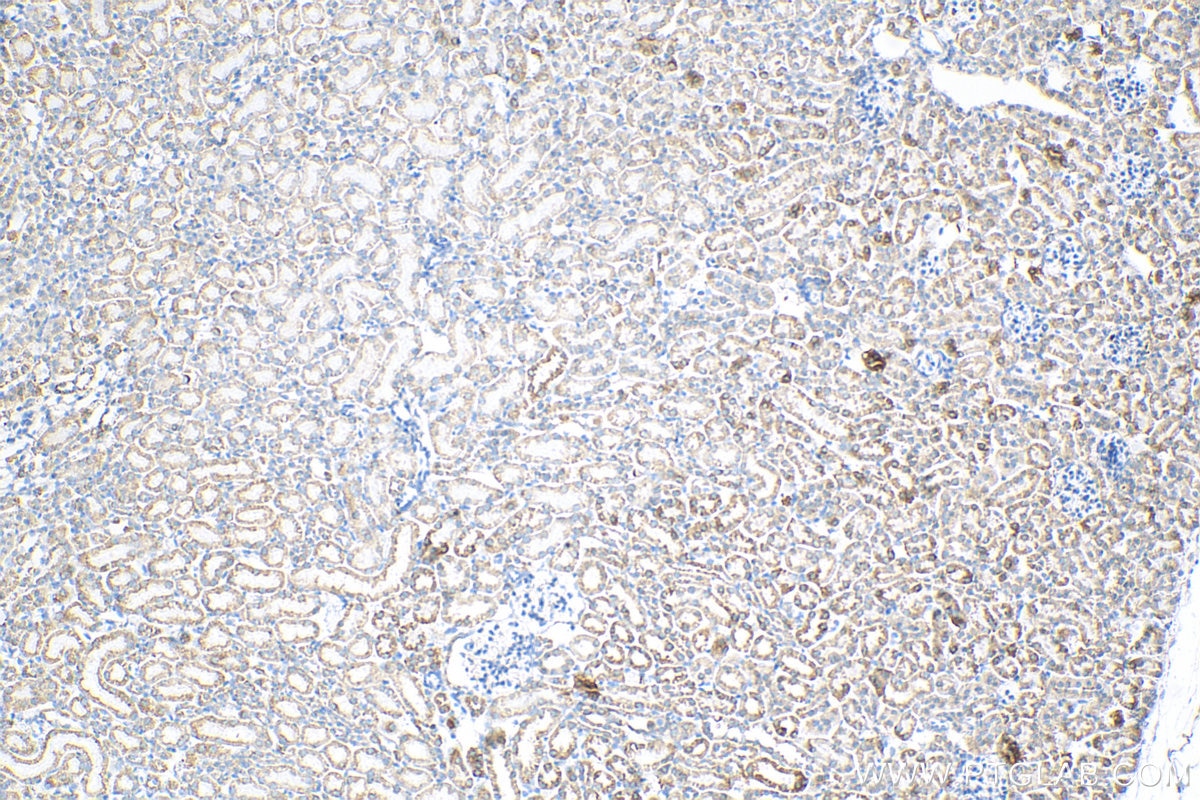 Immunohistochemistry (IHC) staining of mouse kidney tissue using DLAT Monoclonal antibody (68303-1-Ig)