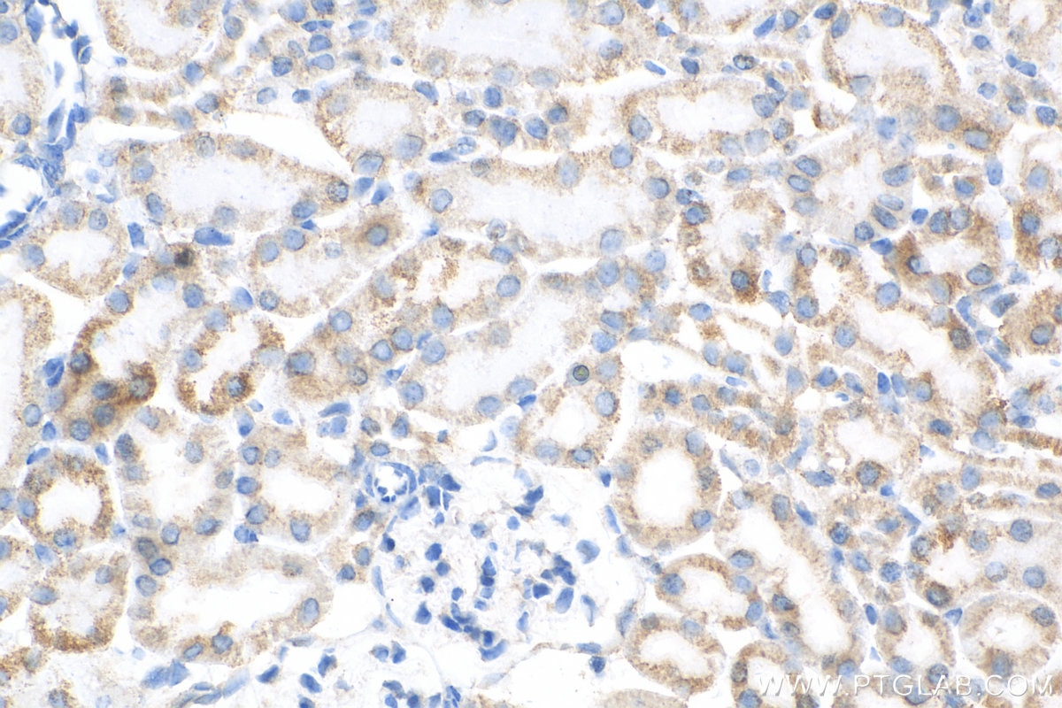 Immunohistochemistry (IHC) staining of mouse kidney tissue using DLAT Monoclonal antibody (68303-1-Ig)