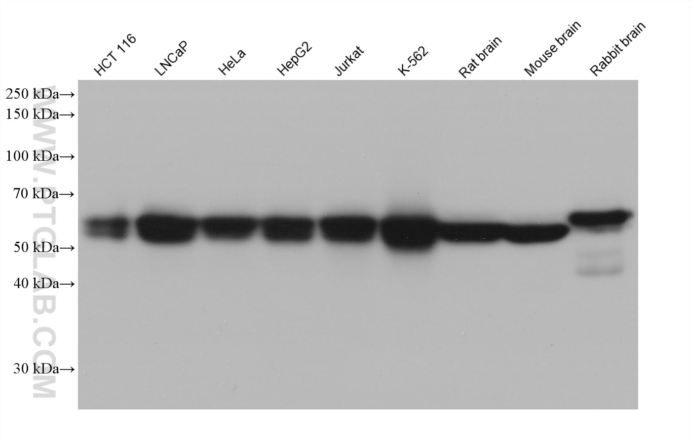 Western Blot (WB) analysis of various lysates using DLAT Monoclonal antibody (68303-1-Ig)