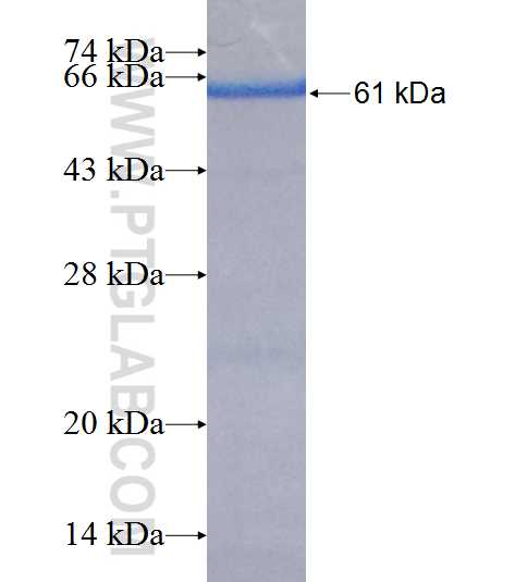DLAT fusion protein Ag22831 SDS-PAGE