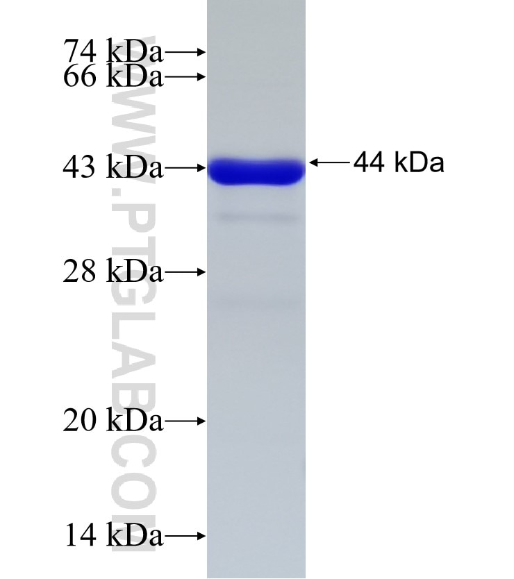 DLAT fusion protein Ag4226 SDS-PAGE