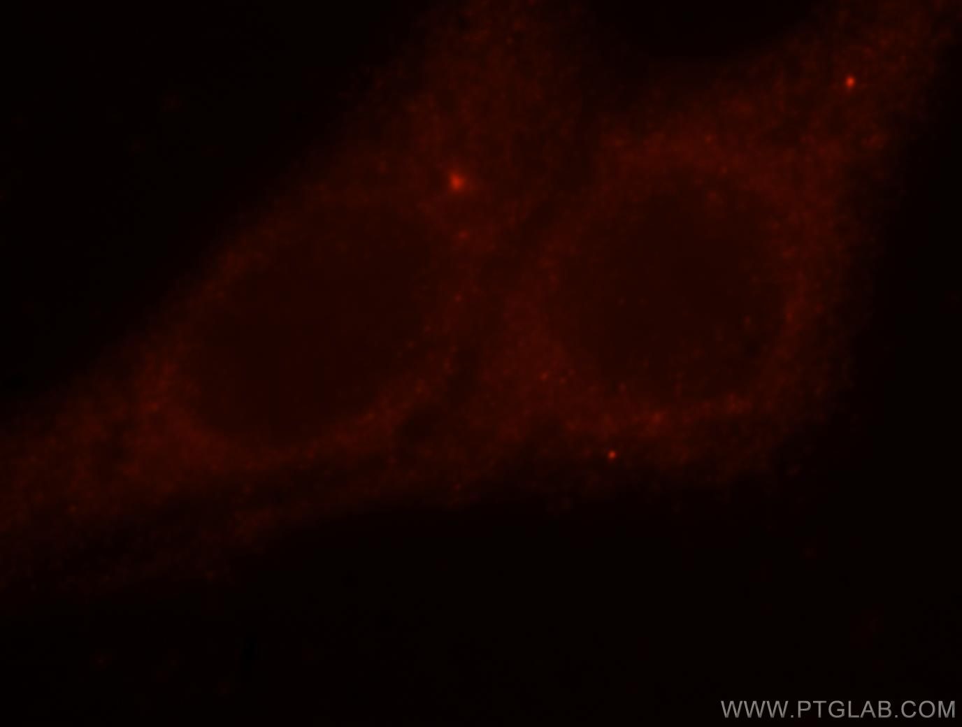 Immunofluorescence (IF) / fluorescent staining of HepG2 cells using DLC1 Polyclonal antibody (15460-1-AP)