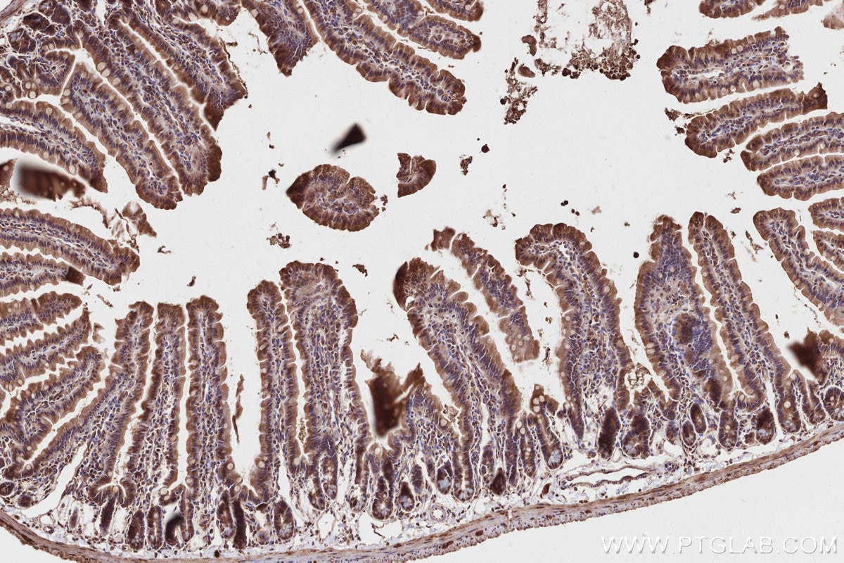Immunohistochemistry (IHC) staining of mouse small intestine tissue using DLC1 Polyclonal antibody (15460-1-AP)