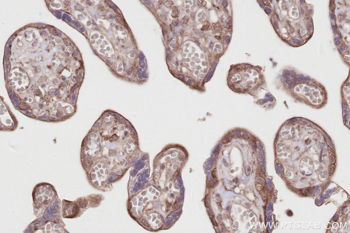 Immunohistochemistry (IHC) staining of human placenta tissue using DLC1 Polyclonal antibody (15460-1-AP)