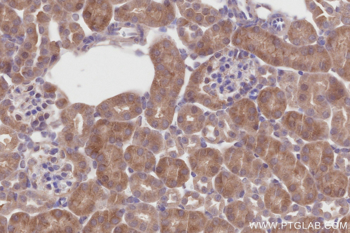 Immunohistochemistry (IHC) staining of mouse kidney tissue using DLC1 Polyclonal antibody (15460-1-AP)