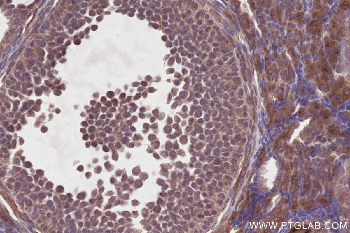 Immunohistochemistry (IHC) staining of mouse ovary tissue using DLC1 Polyclonal antibody (15460-1-AP)
