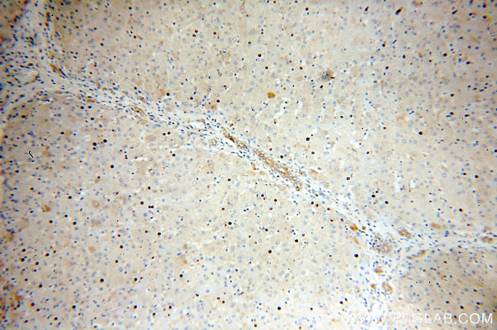 Immunohistochemistry (IHC) staining of human liver tissue using DLC1 Polyclonal antibody (15460-1-AP)