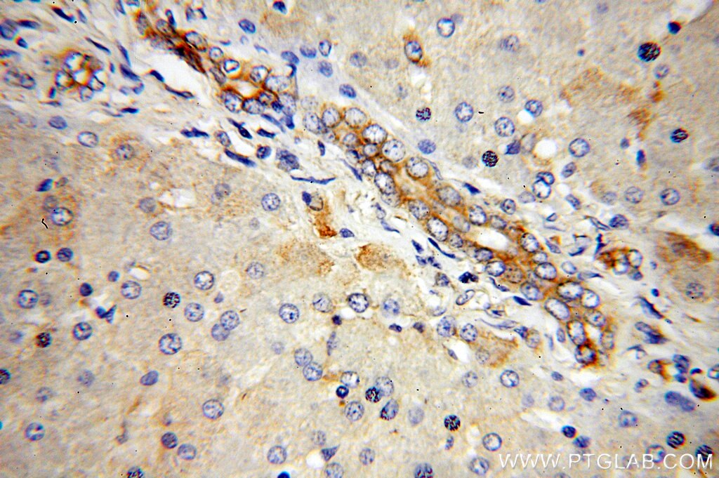 Immunohistochemistry (IHC) staining of human liver tissue using DLC1 Polyclonal antibody (15460-1-AP)