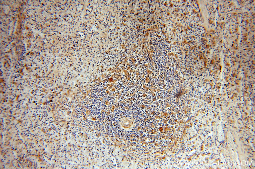 Immunohistochemistry (IHC) staining of human spleen tissue using DLC1 Polyclonal antibody (15460-1-AP)