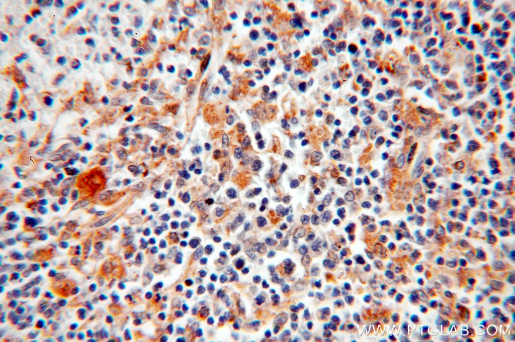 Immunohistochemistry (IHC) staining of human spleen tissue using DLC1 Polyclonal antibody (15460-1-AP)