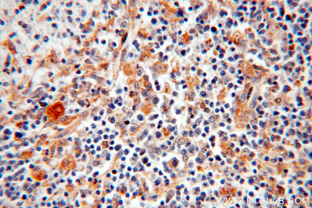 IHC staining of human spleen using 15460-1-AP