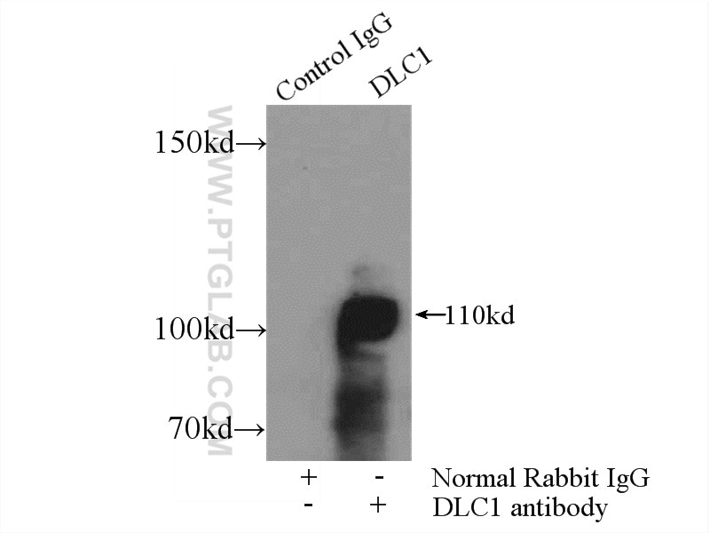 Immunoprecipitation (IP) experiment of mouse lung tissue using DLC1 Polyclonal antibody (15460-1-AP)
