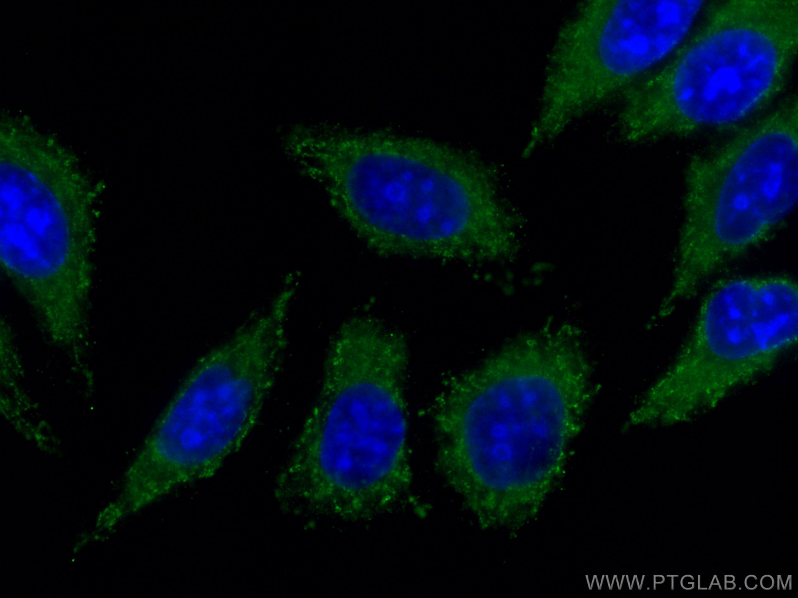 Immunofluorescence (IF) / fluorescent staining of HepG2 cells using DLC1 Monoclonal antibody (66894-1-Ig)