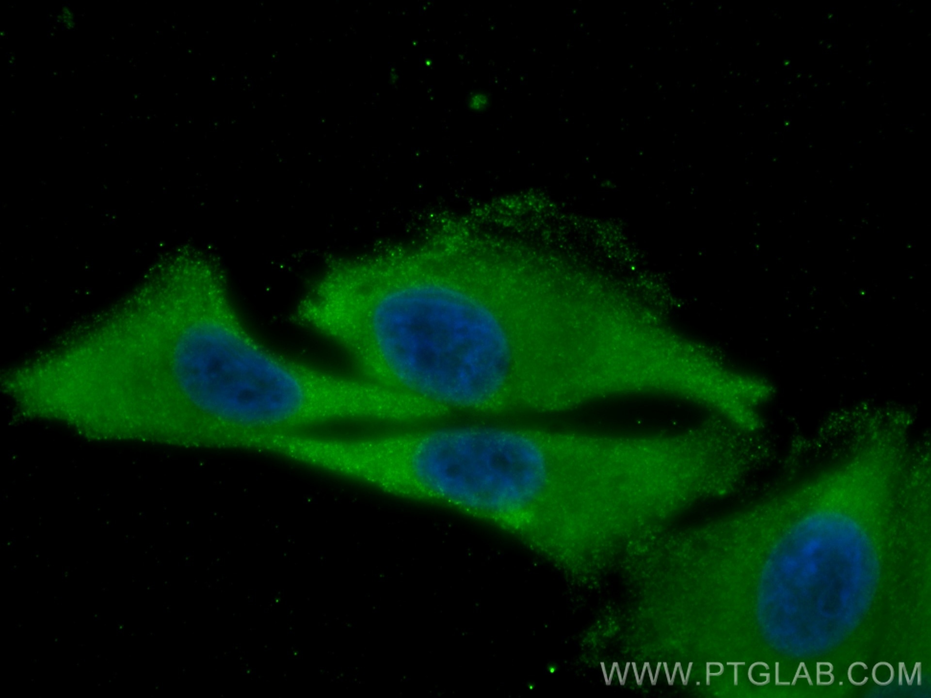 Immunofluorescence (IF) / fluorescent staining of A375 cells using DLC1 Monoclonal antibody (66894-1-Ig)