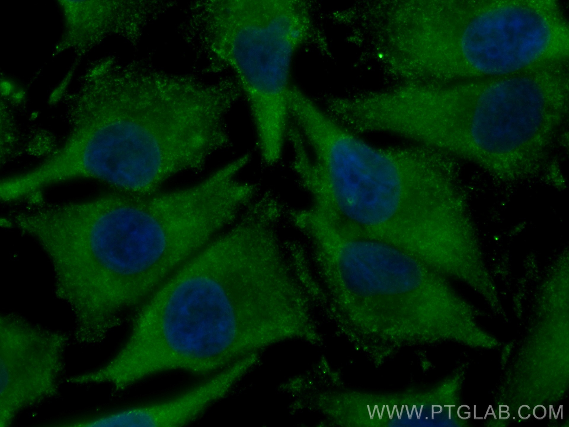 Immunofluorescence (IF) / fluorescent staining of A375 cells using CoraLite® Plus 488-conjugated DLC1 Monoclonal anti (CL488-66894)