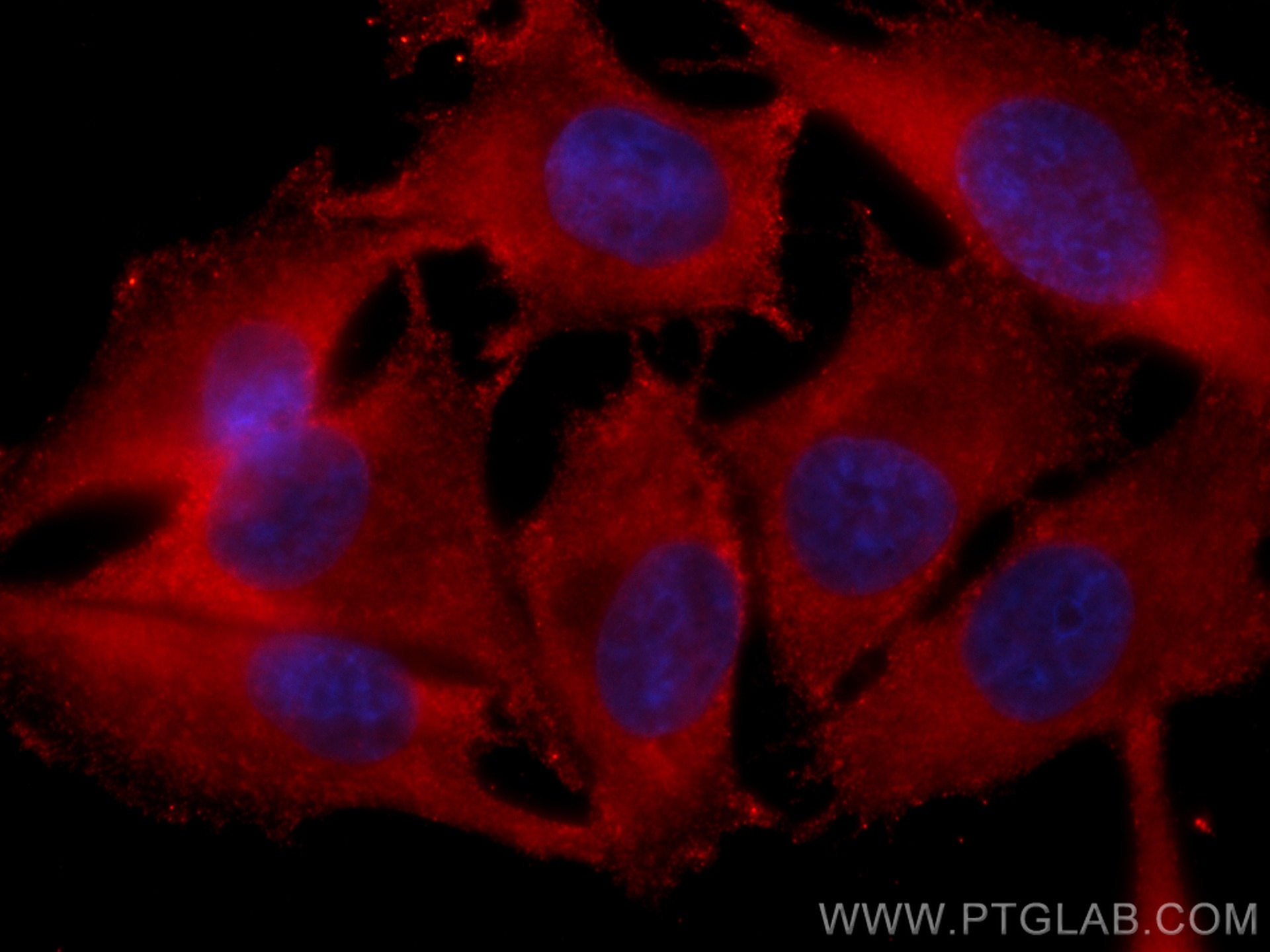 Immunofluorescence (IF) / fluorescent staining of A375 cells using CoraLite®594-conjugated DLC1 Monoclonal antibody (CL594-66894)