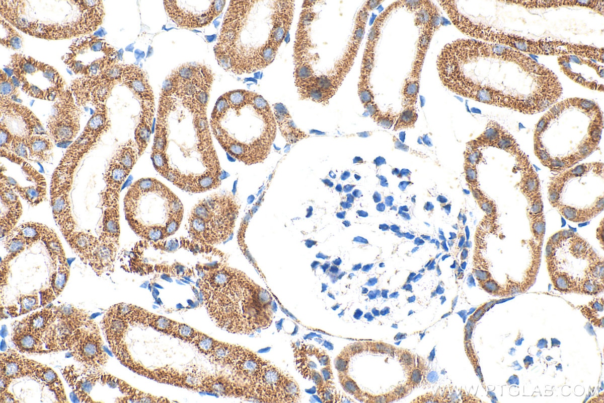 Immunohistochemistry (IHC) staining of mouse kidney tissue using DLD Polyclonal antibody (16431-1-AP)