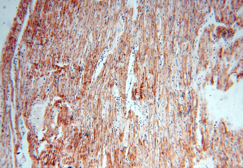 IHC staining of human heart using 16431-1-AP