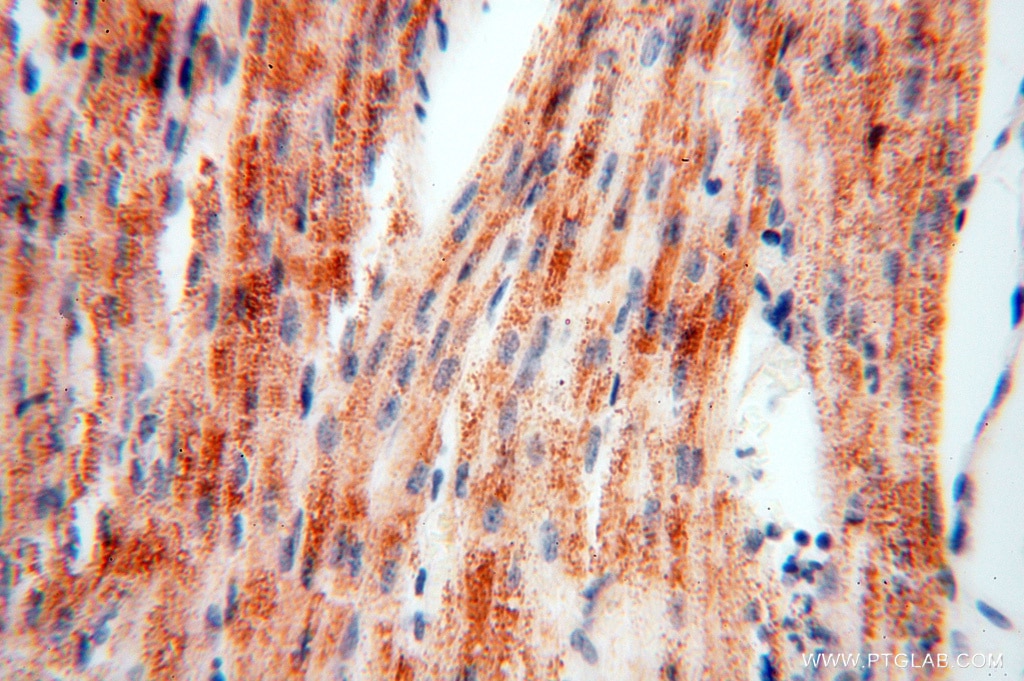 IHC staining of human heart using 16431-1-AP