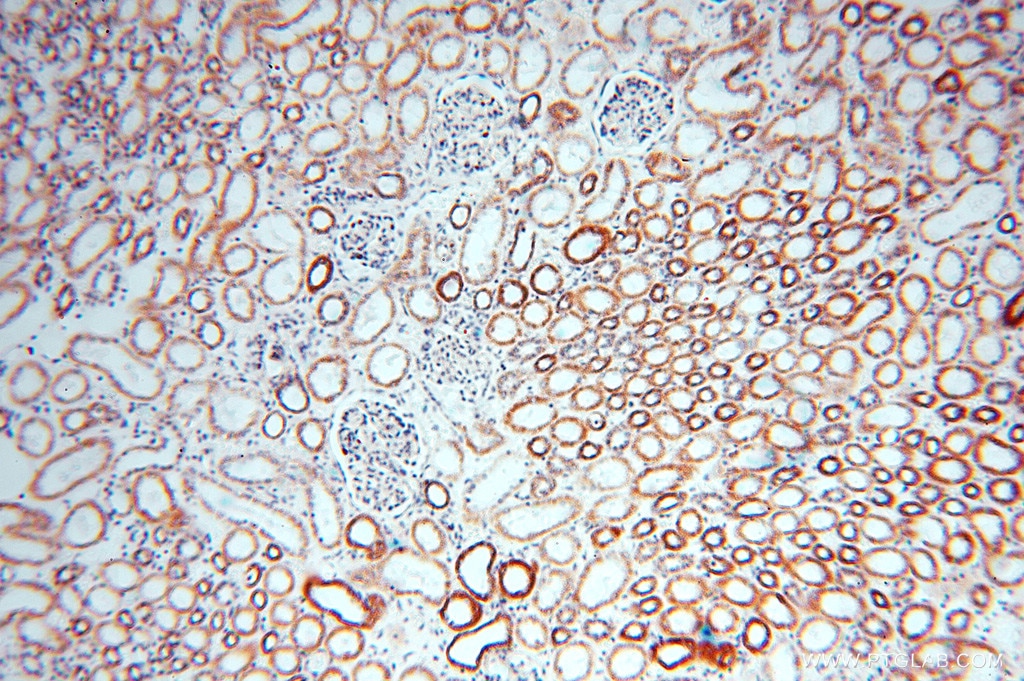 Immunohistochemistry (IHC) staining of human kidney tissue using DLD Polyclonal antibody (16431-1-AP)