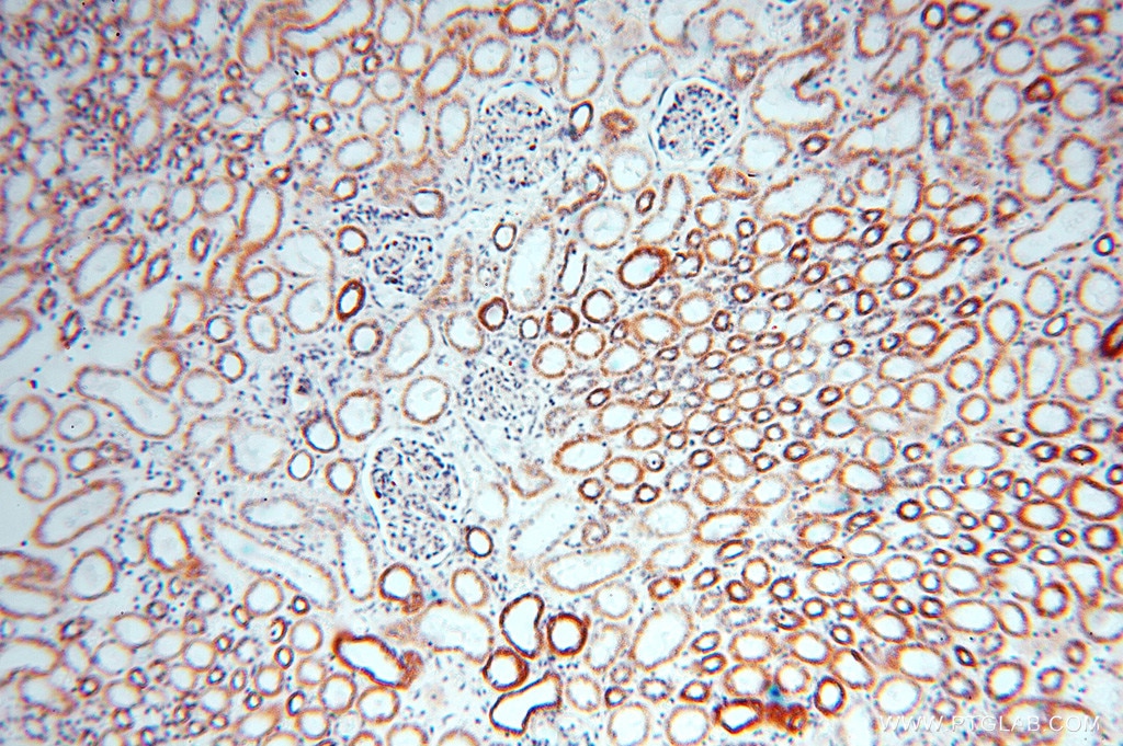 IHC staining of human kidney using 16431-1-AP