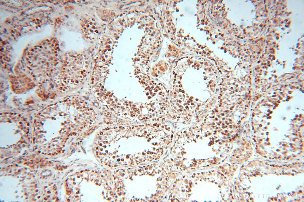 Immunohistochemistry (IHC) staining of human testis tissue using DLD Polyclonal antibody (16431-1-AP)