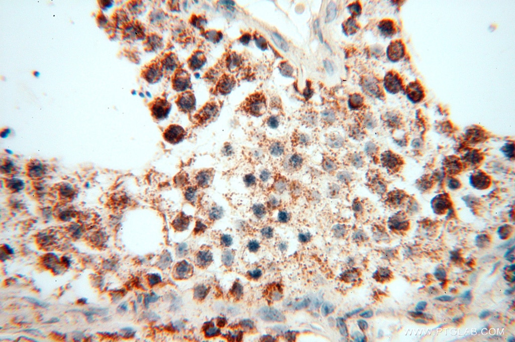 Immunohistochemistry (IHC) staining of human testis tissue using DLD Polyclonal antibody (16431-1-AP)