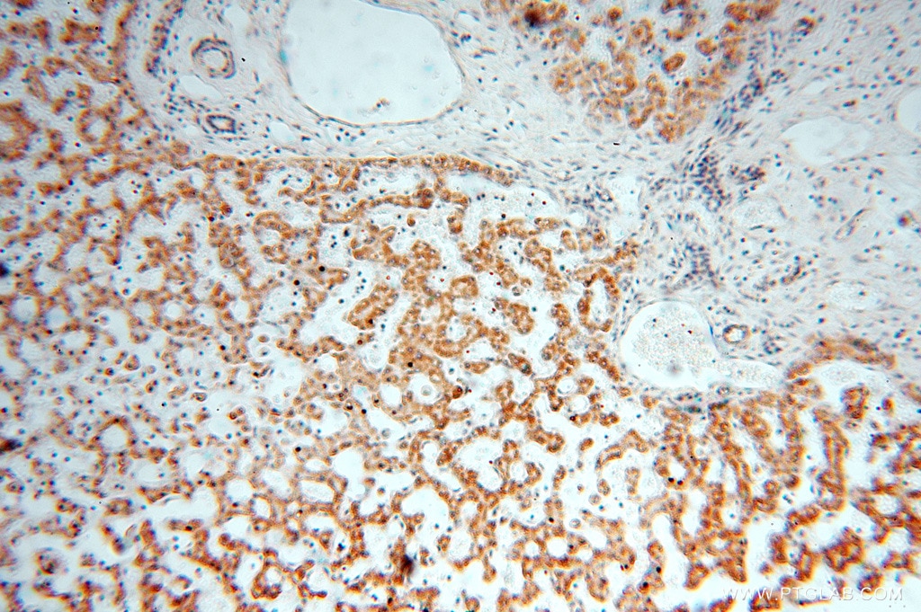 Immunohistochemistry (IHC) staining of human liver tissue using DLD Polyclonal antibody (16431-1-AP)