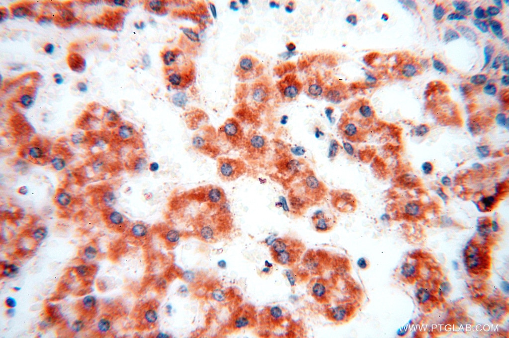 Immunohistochemistry (IHC) staining of human liver tissue using DLD Polyclonal antibody (16431-1-AP)