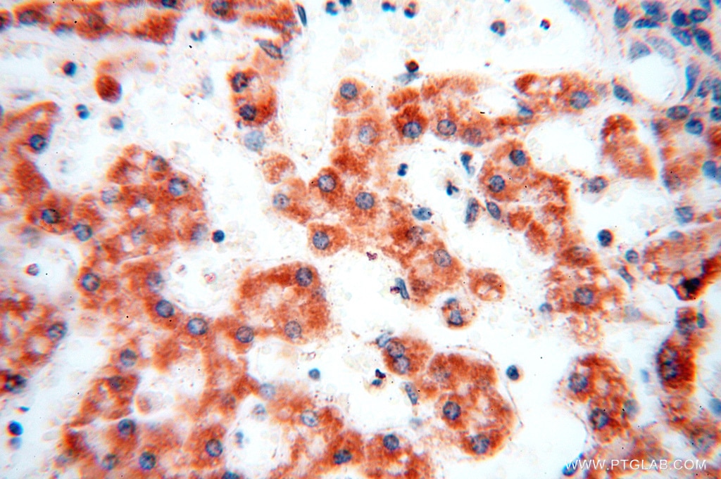 IHC staining of human liver using 16431-1-AP