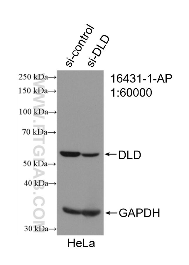 Western Blot (WB) analysis of HeLa cells using DLD Polyclonal antibody (16431-1-AP)