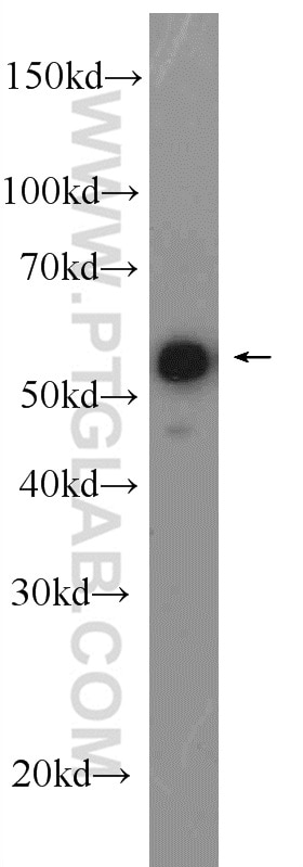 Western Blot (WB) analysis of mouse heart tissue using DLD Polyclonal antibody (16431-1-AP)