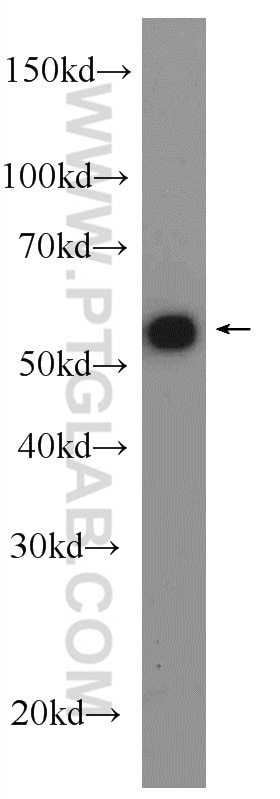 Western Blot (WB) analysis of mouse heart tissue using DLD Polyclonal antibody (16431-1-AP)