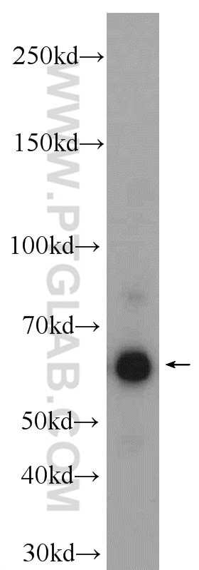 Western Blot (WB) analysis of rat brain tissue using DLD Polyclonal antibody (16431-1-AP)