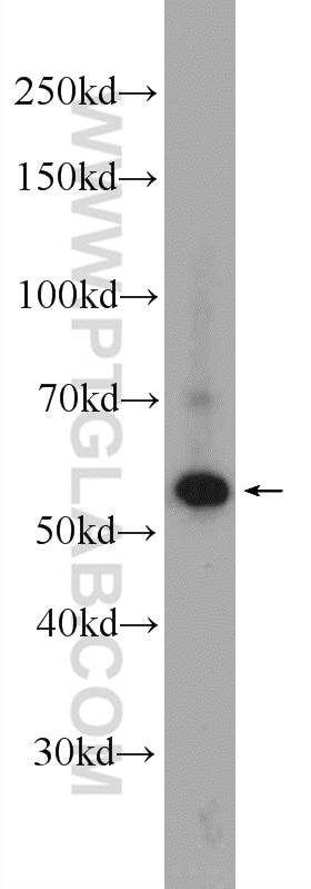 Western Blot (WB) analysis of HeLa cells using DLD Polyclonal antibody (16431-1-AP)