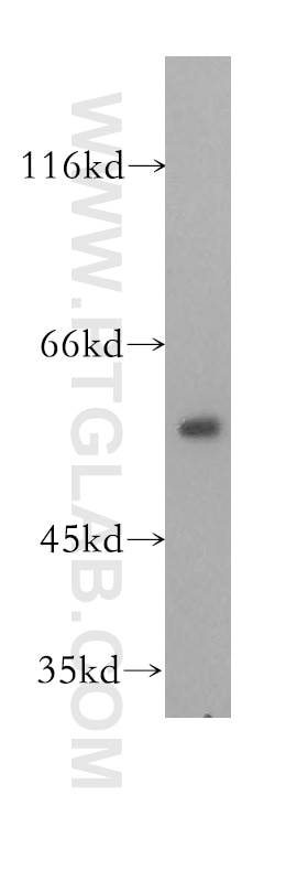 Western Blot (WB) analysis of human liver tissue using DLD Polyclonal antibody (16431-1-AP)
