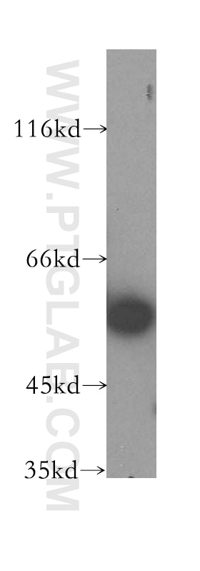 Western Blot (WB) analysis of HepG2 cells using DLD Polyclonal antibody (16431-1-AP)