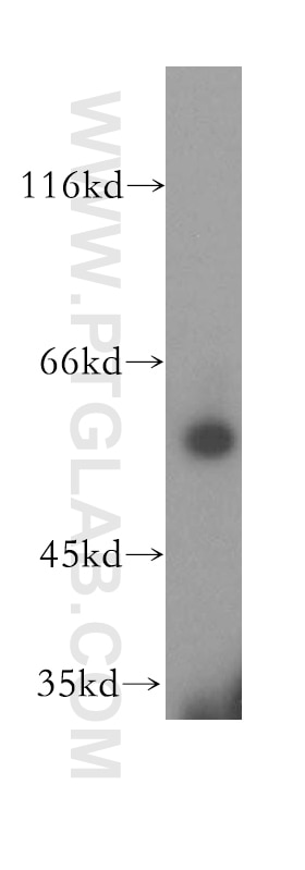 Western Blot (WB) analysis of human brain tissue using DLD Polyclonal antibody (16431-1-AP)