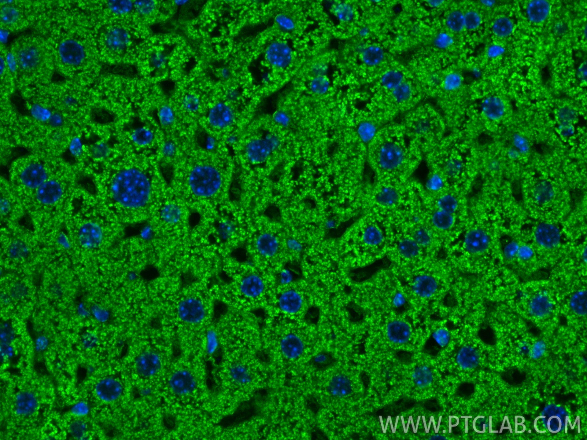 IF Staining of mouse liver using 67702-1-Ig Immunofluorescence (IF) / fluorescent staining of mouse liver tissue using DLD Monoclonal antibody (67702-1-Ig)