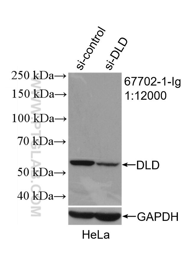 Western Blot (WB) analysis of HeLa cells using DLD Monoclonal antibody (67702-1-Ig)