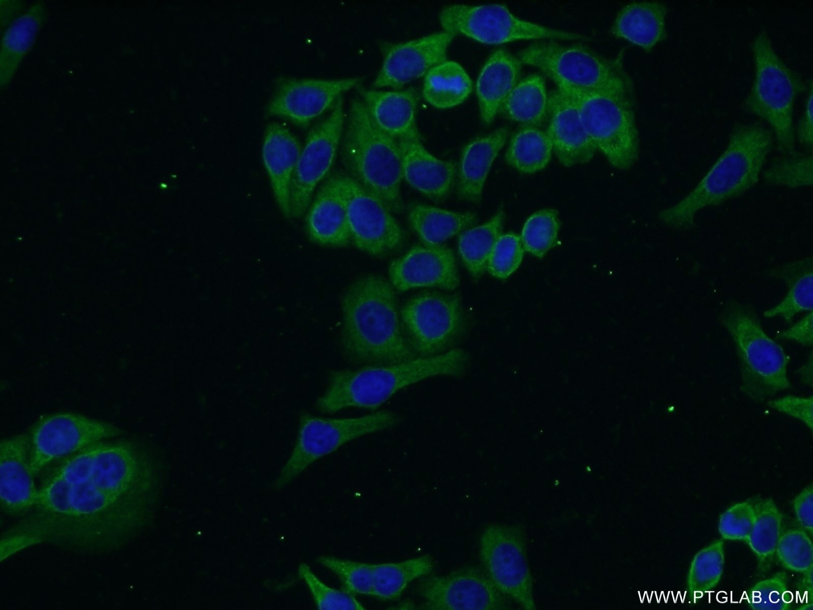 Immunofluorescence (IF) / fluorescent staining of PC-3 cells using DLEC1 Polyclonal antibody (20027-1-AP)