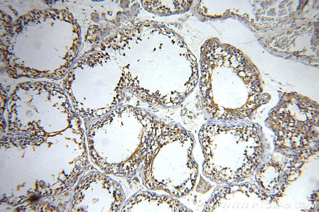 Immunohistochemistry (IHC) staining of human testis tissue using DLEC1 Polyclonal antibody (20027-1-AP)