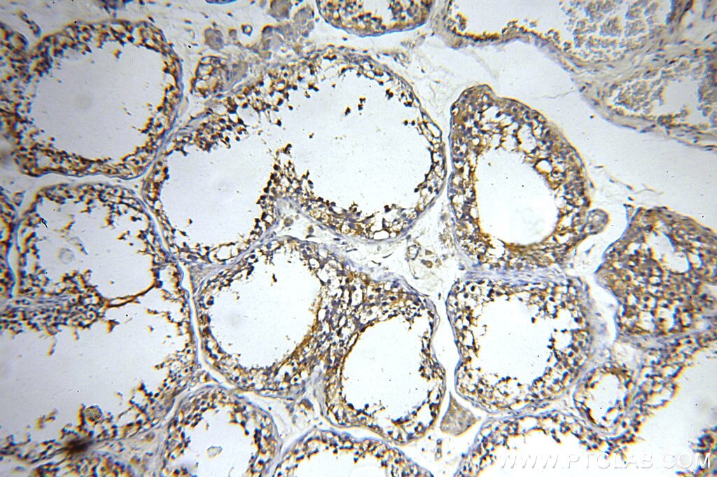 IHC staining of human testis using 20027-1-AP